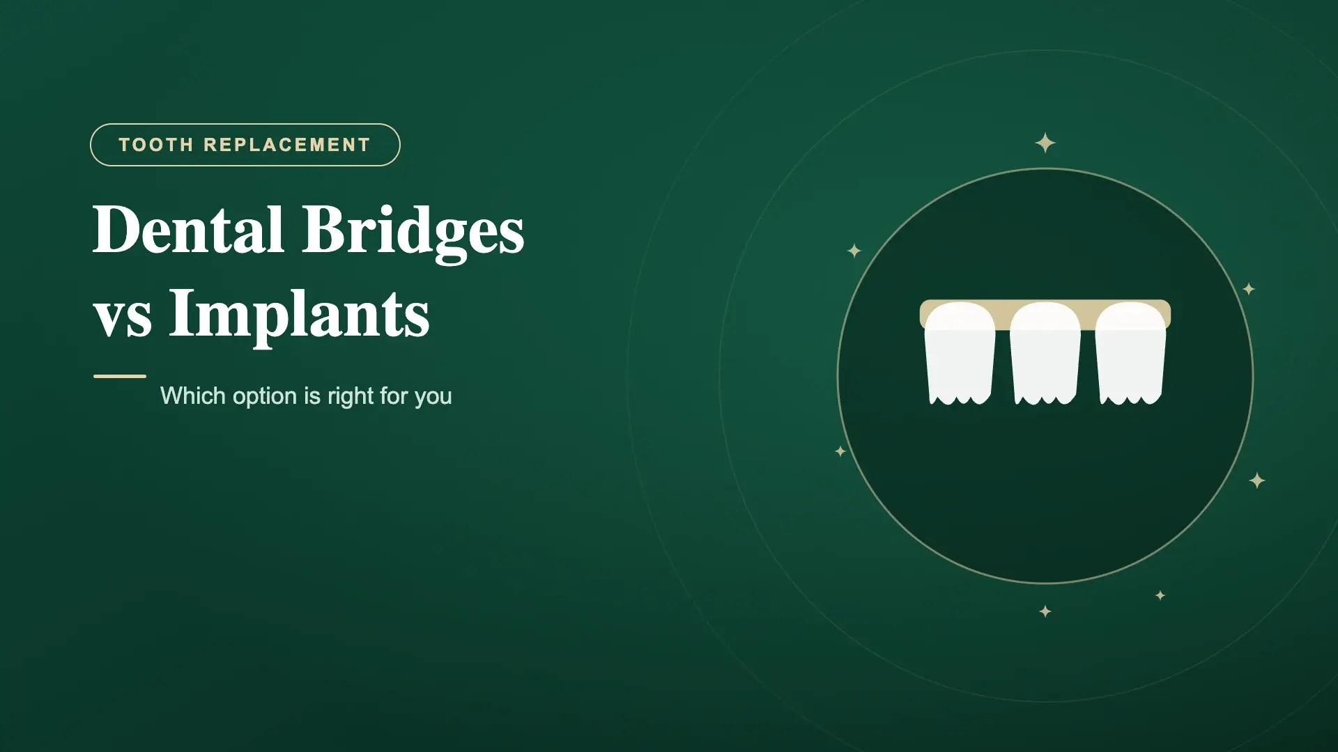 Dental Bridge vs Implant in India (2026): Cost, Lifespan and Which to Choose