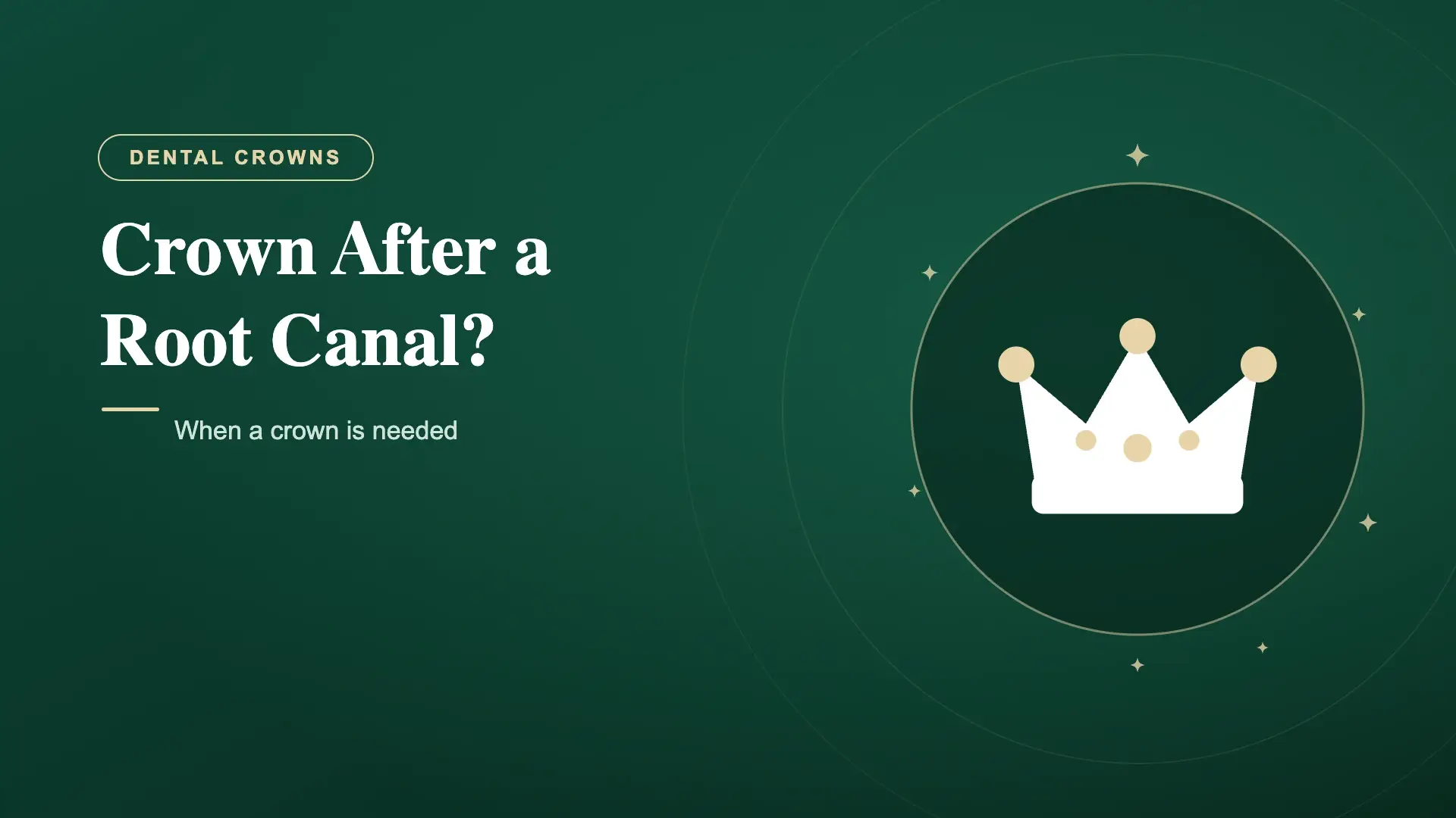 Do You Need a Crown After a Root Canal? (2026 Guide)