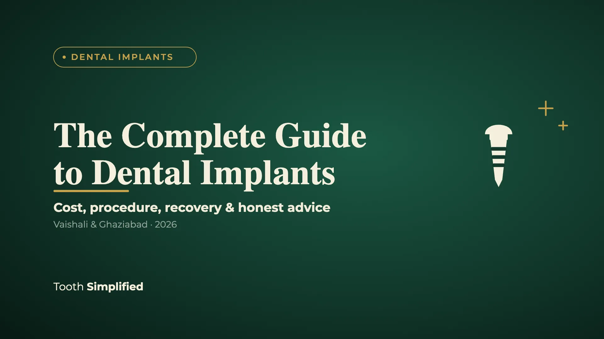 Dental Implants: The Complete Guide