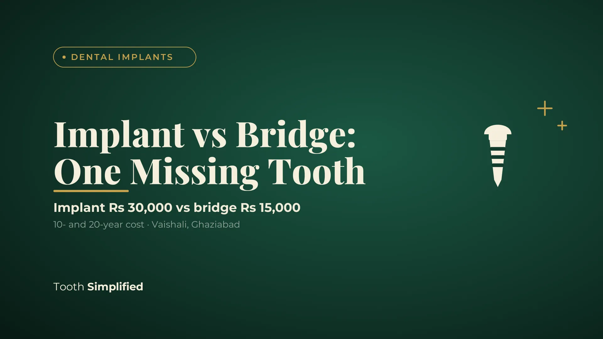 Implant vs bridge for one missing tooth: Rs 30,000 implant vs Rs 15,000 bridge over 10 and 20 years, Ghaziabad